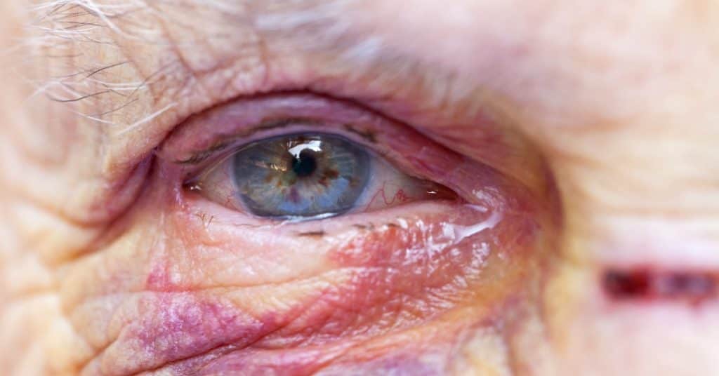 recognizing nursing home abuse